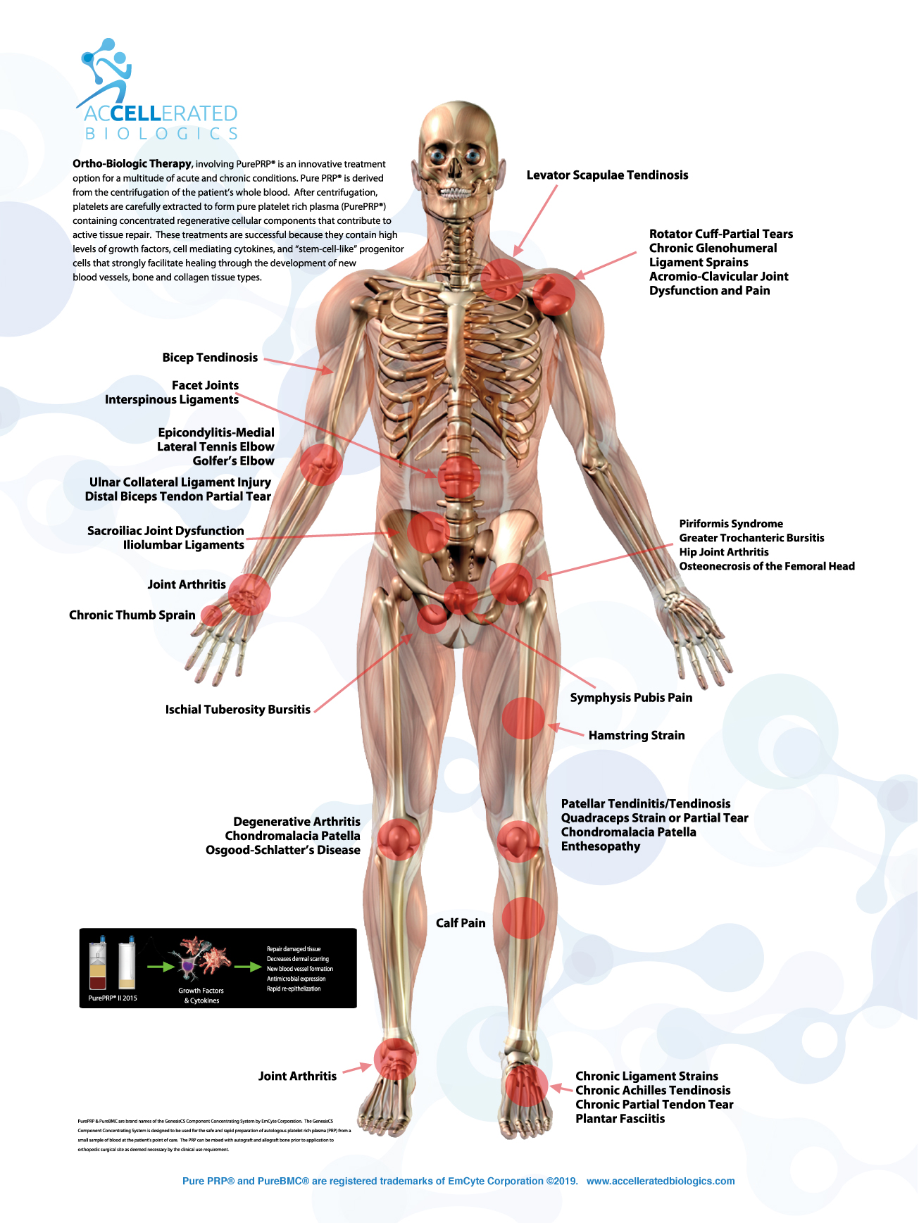 Orthobiologic Poster